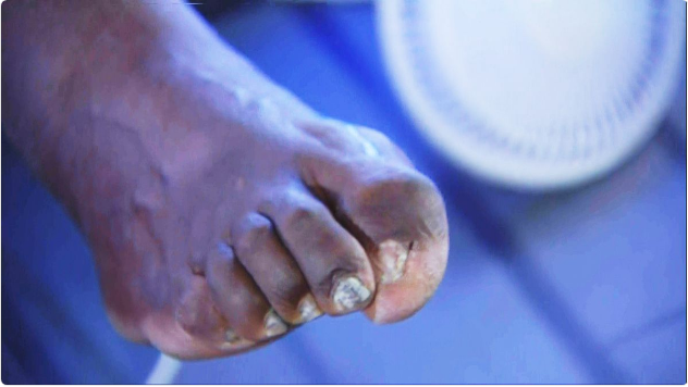 Funniest Shaq memes after showing hideous toes on TNT - Rolling Out