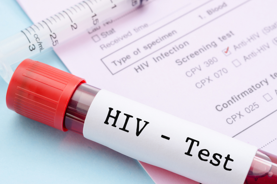 Today is National HIV Testing Day and the 35th anniversary of the AIDS epidemic