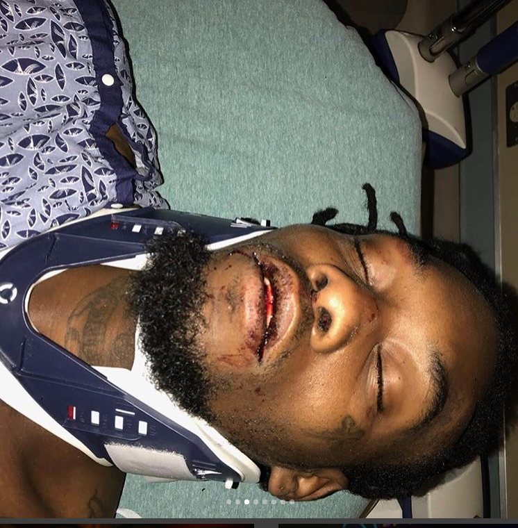 Offset's bad car accident and injuries (graphic photos)