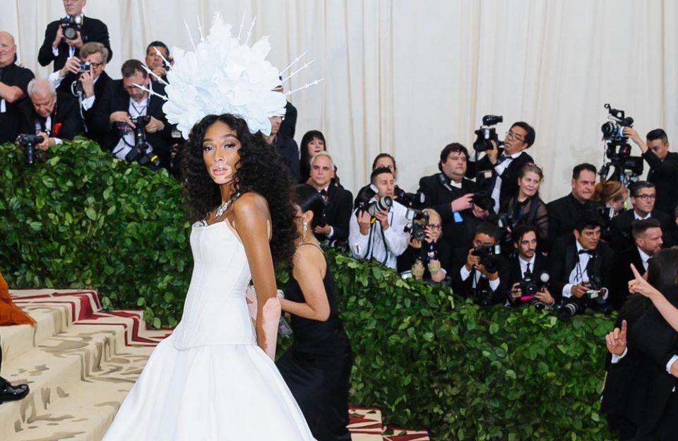 Winnie Harlow no longer worried about bullies