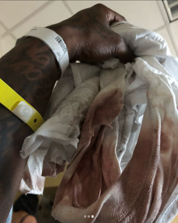 Lil Scrappy seriously injured in horrific car crash (photos)