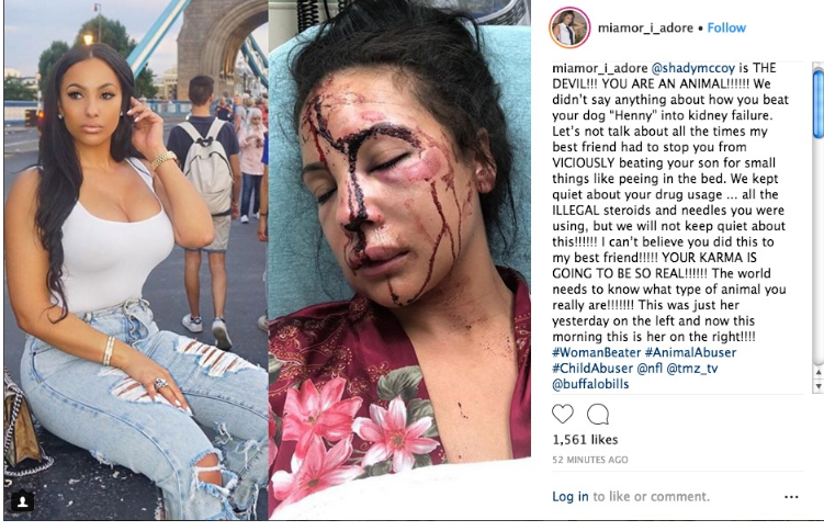 LeSean McCoy accused of brutal beatdown of girlfriend (photo); his response