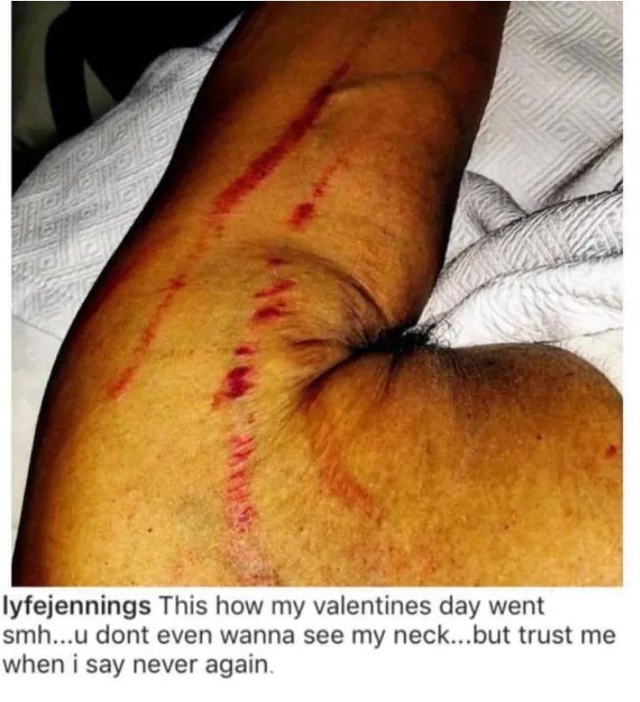 Lyfe Jennings allegedly beaten by girlfriend on Valentine's Day (photos)