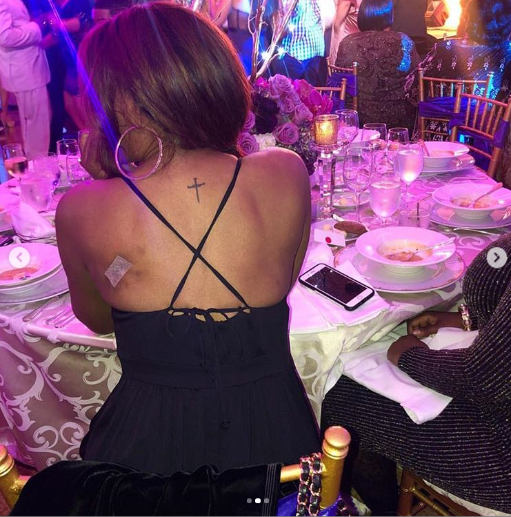 Cynthia Bailey posts graphic photo of removed tumor