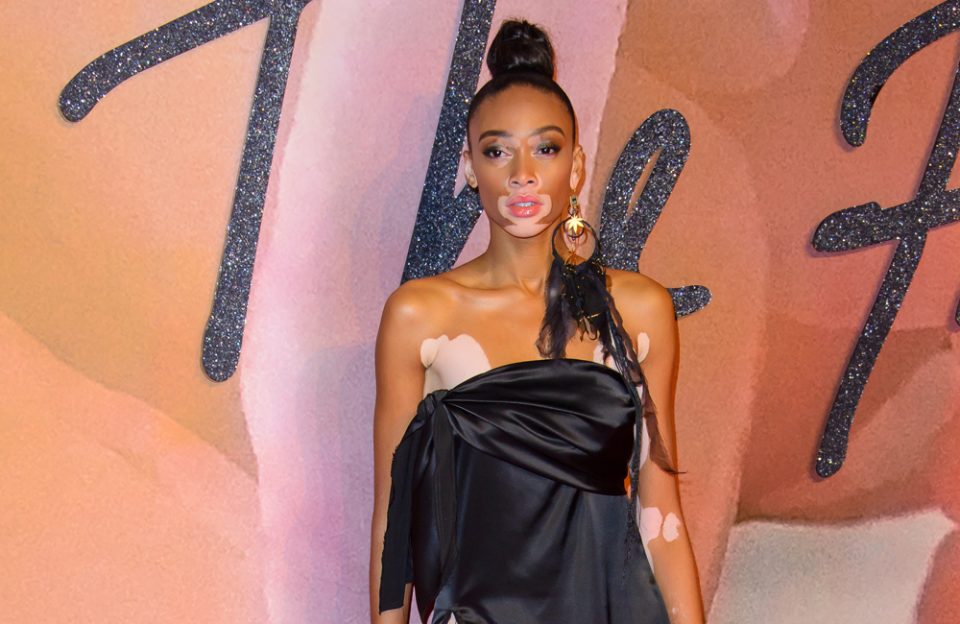 Supermodel Winnie Harlow shares top beauty tip