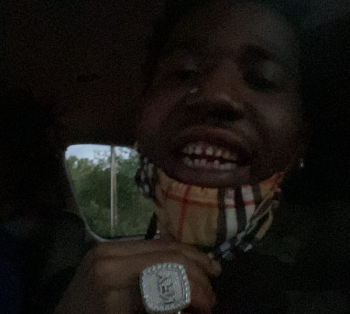 YFN Lucci's teeth get clowned after he removes his diamond grill (photo)