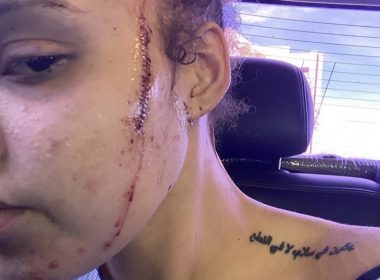 Michael Jackson's niece allegedly stabbed 7 times by racist White woman