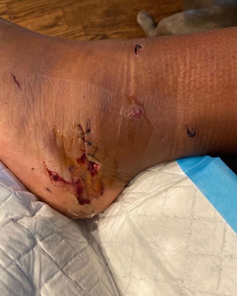 Graphic photos of Megan Thee Stallion's bullet wounds surface