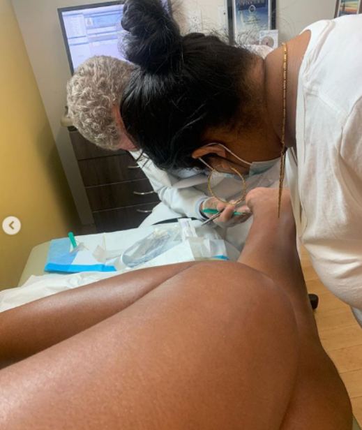 Graphic photos of Megan Thee Stallion's bullet wounds surface