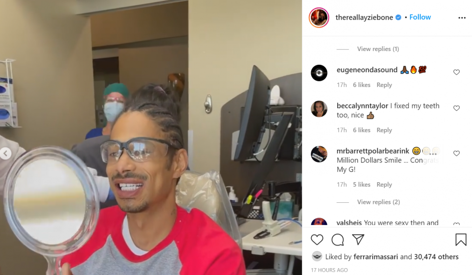 Bone Thugs-N-Harmony member Layzie Bone shows off his smile