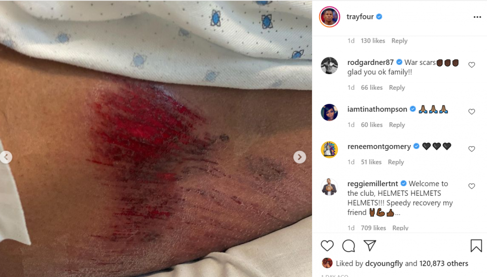 Retired NBA champion Ray Allen recovering after bicycle accident (photos)