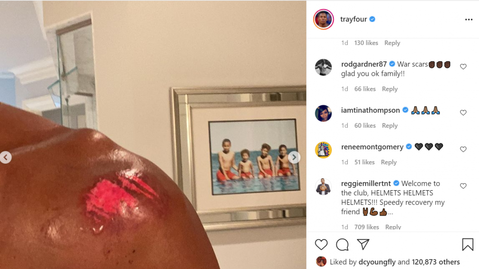 Retired NBA champion Ray Allen recovering after bicycle accident (photos)