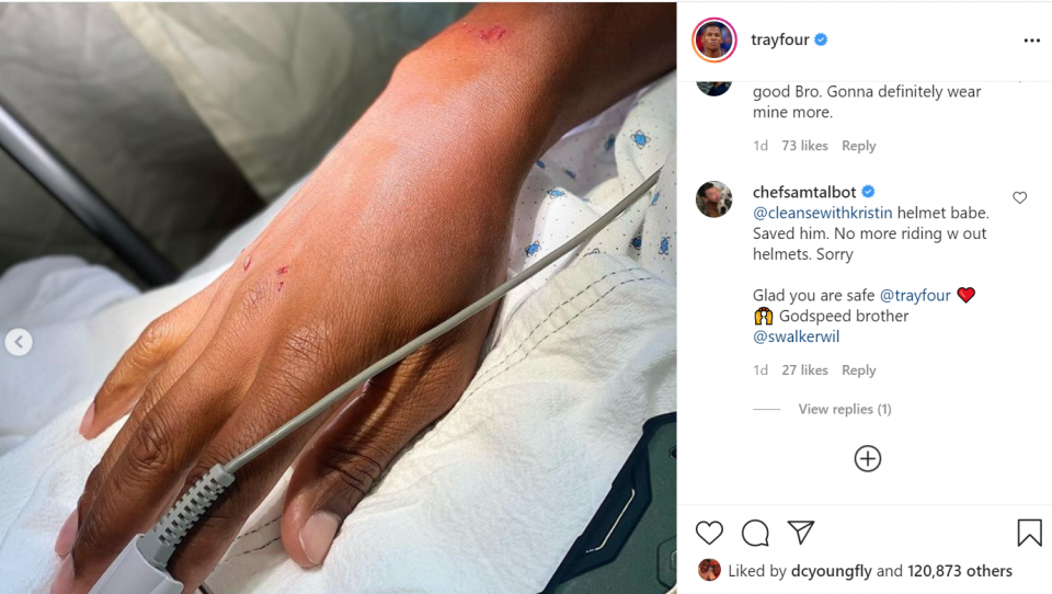 Retired NBA champion Ray Allen recovering after bicycle accident (photos)