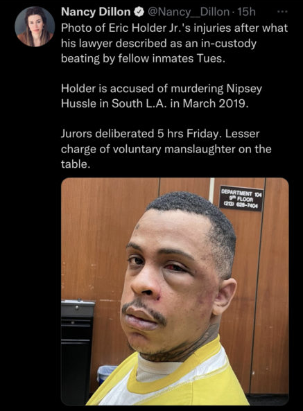 Nipsey Hussle's accused killer shows up to court with battered face (photo)