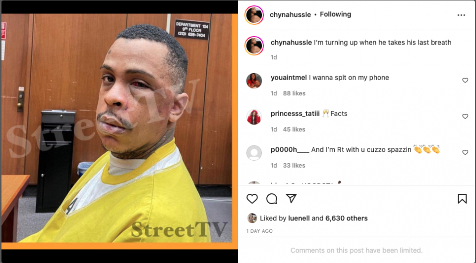 Nipsey Hussle's accused killer shows up to court with battered face (photo)