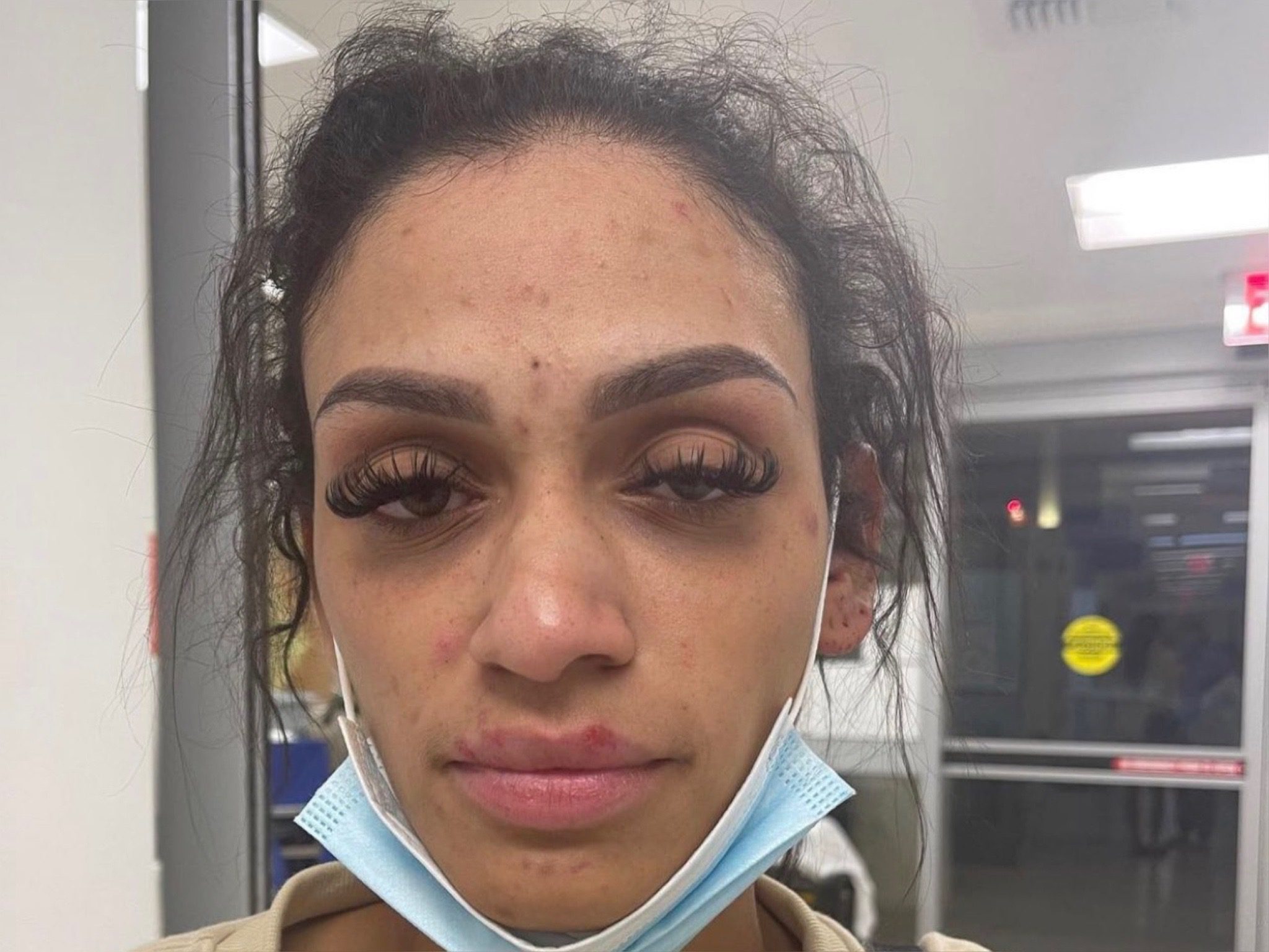 NBA wife shows gruesome photos of her face after being physically abused