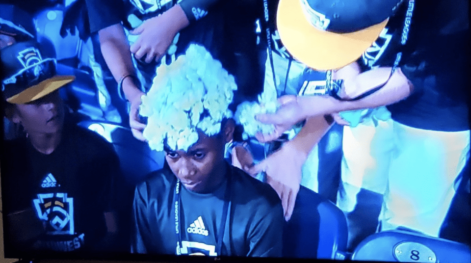 Little league team puts cotton on Black player's head (video)