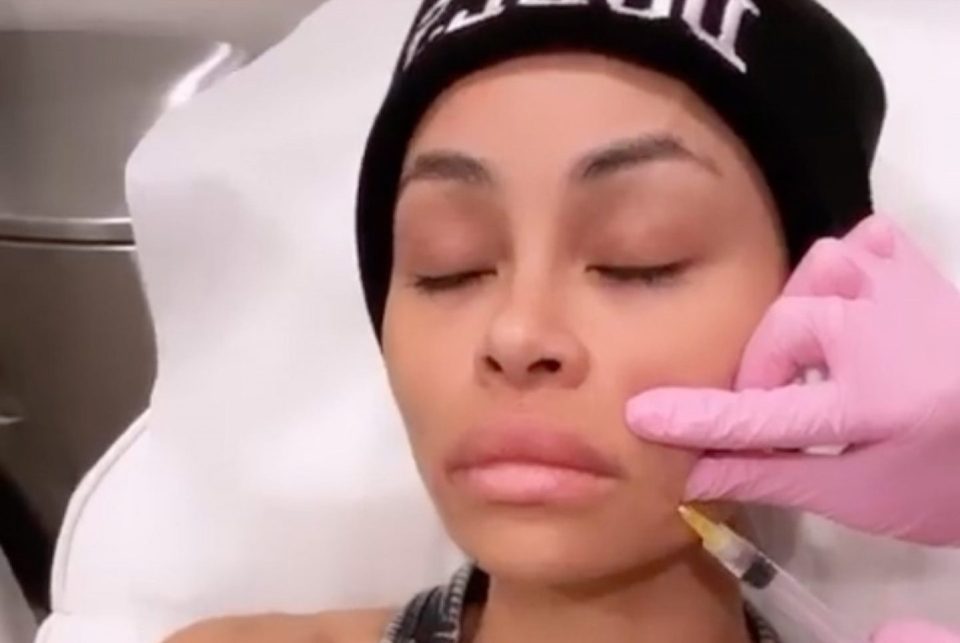 Blac Chyna shocks fans with video of her 6th facial filler dissolving