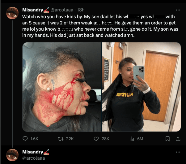 Mother of NBA YoungBoy's child claims he had her beaten (photos)
