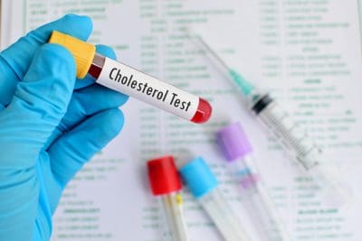 cholesterol screenings