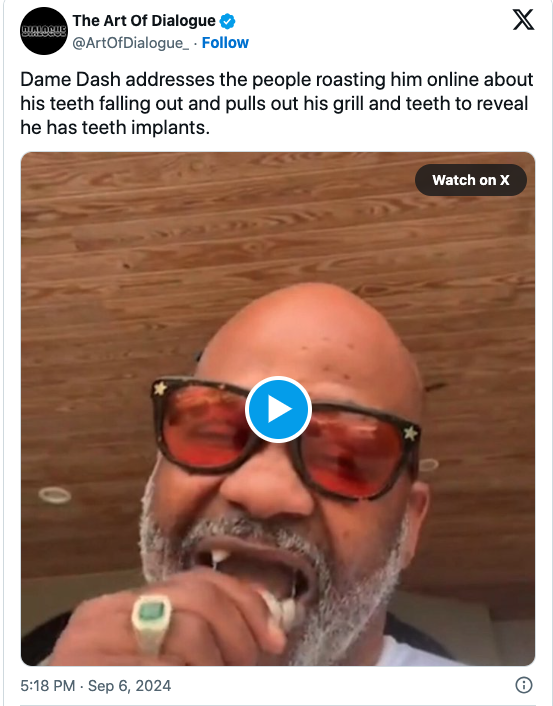 Dame Dash's laughs off his dentures falling out and 50 Cent clowning him