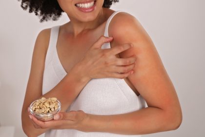 foods, food allergies, and chronic illness