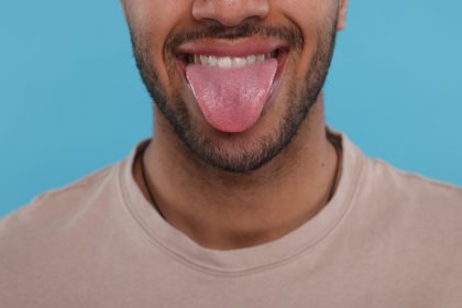 swollen tongue