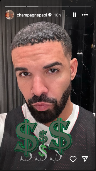 Drake flamed for rocking strange new hairstyle (photo)