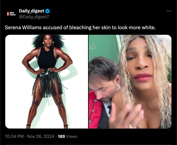 Serena Williams fires back at fans' skin bleaching claims