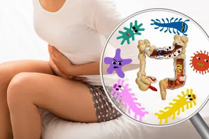 Signs of Crohn's disease