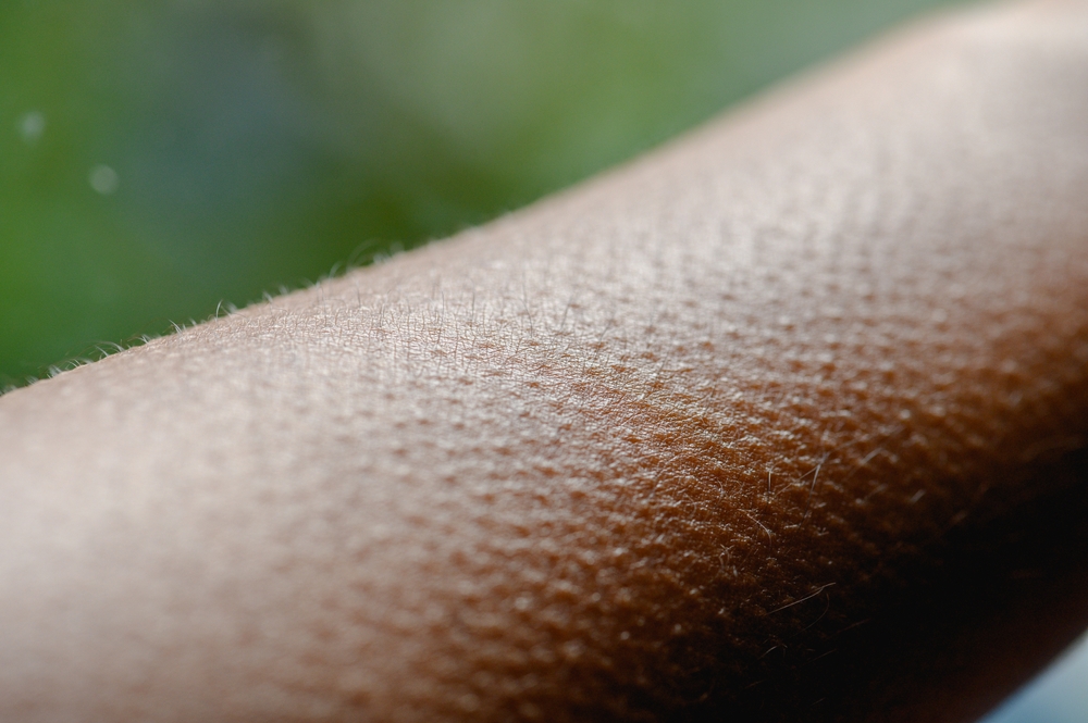 goosebumps, health