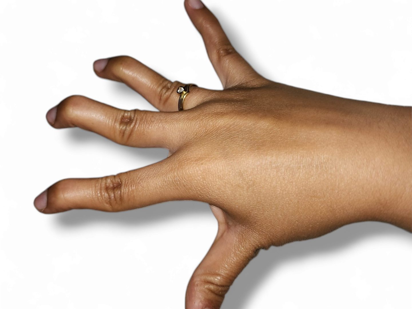 hand, tingling