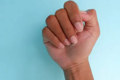 nails, broken, hormones, health