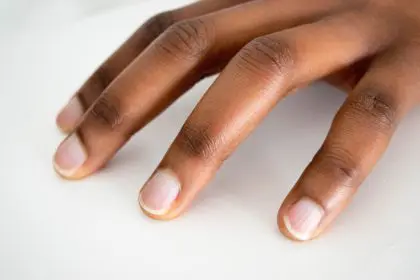 nails, health, liver