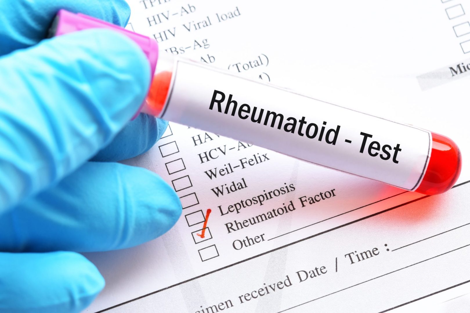rheumatoid factor tests