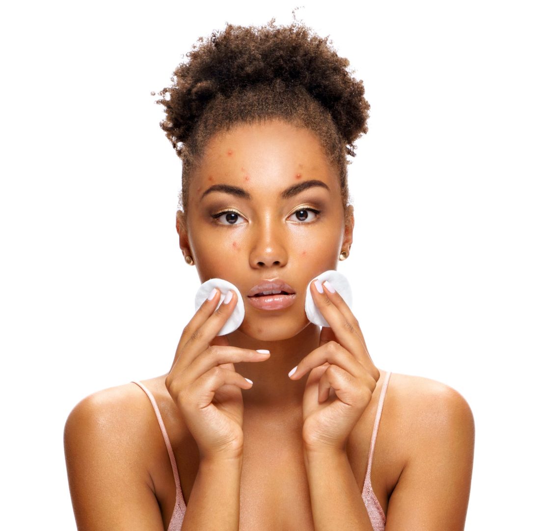 Goodbye to acne