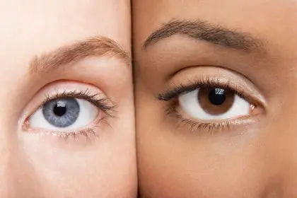 eye, color, pain