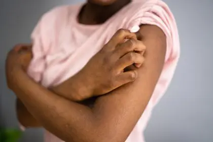 Skin, rashes, health