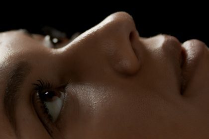 Bell's Palsy, nerve condition