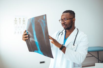 lung cancer risk
