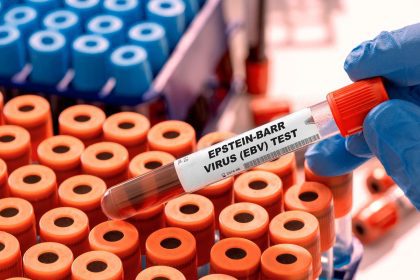 Epstein-Barr and your health