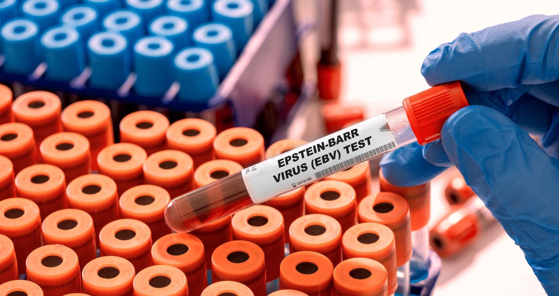 Epstein-Barr and your health