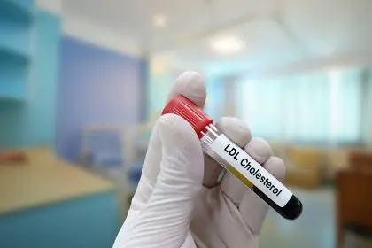 Ways to reduce cholesterol