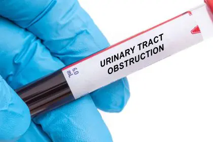 Urinary blockages threaten kidney
