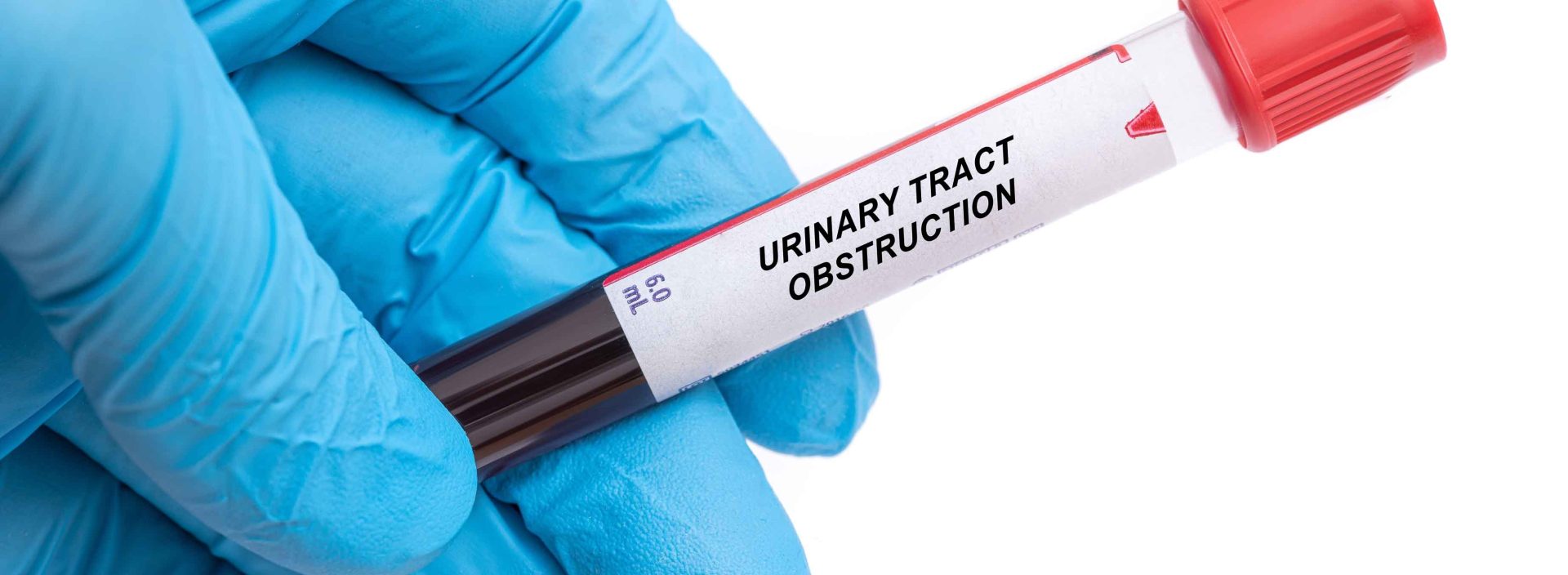 Urinary blockages threaten kidney