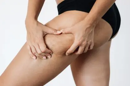 Money-saving truth - cellulite