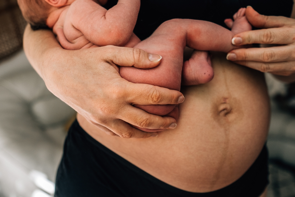postpartum depression