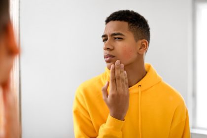 Rash, skin, health