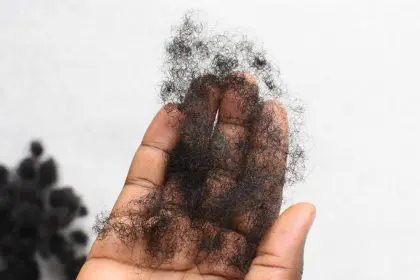 Does creatine cause hair loss
