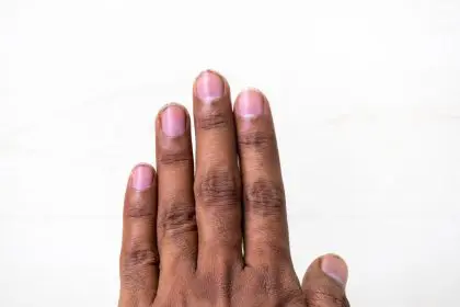 dirt, hands, fingernails, health